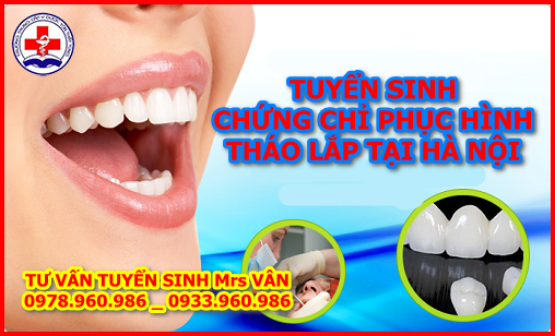 Phục hình tháo lắp