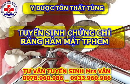 Răng hàm mặt