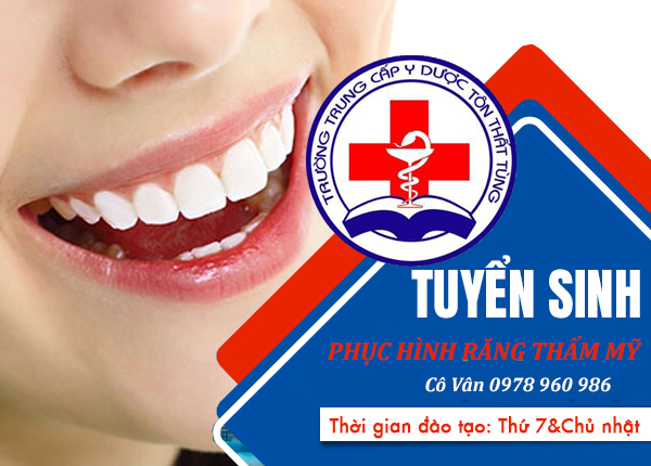 phục hình răng thẩm mỹ