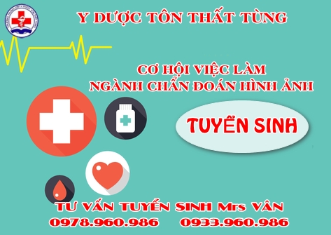 Việc làm khi học kỹ thuật chẩn đoán hình ảnh