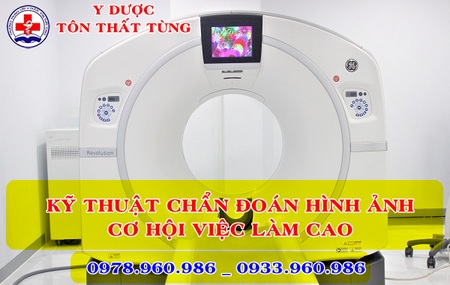 Việc làm khi học trung cấp chẩn đoán hình ảnh năm 2024