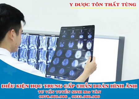 Khóa chẩn đoán hình ảnh y học cần tố chất gì?