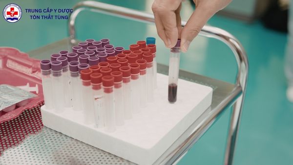 Mức lương của ngành Xét nghiệm Y học