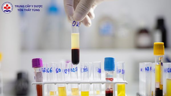 có nên học xét nghiệm y học