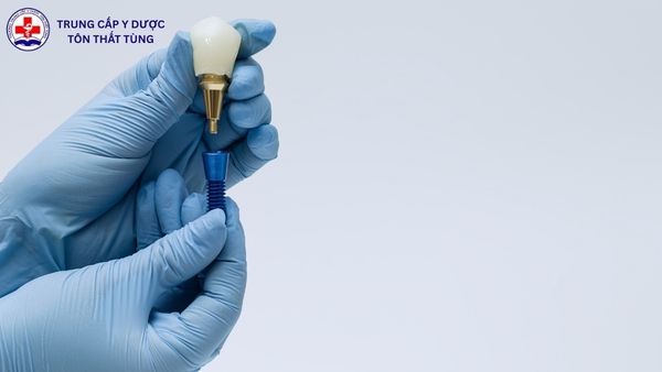 kỹ thuật phục hình răng làm gì