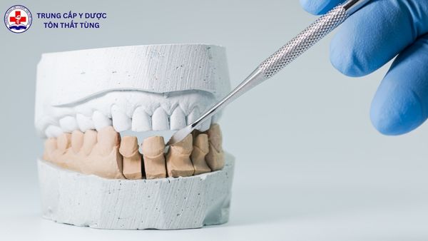 kỹ thuật phục hình răng làm gì