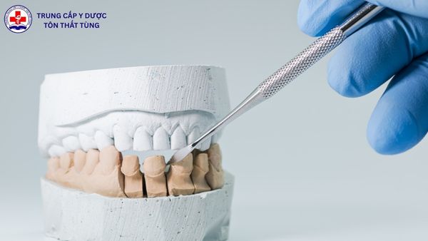 lương kỹ thuật viên phục hình răng